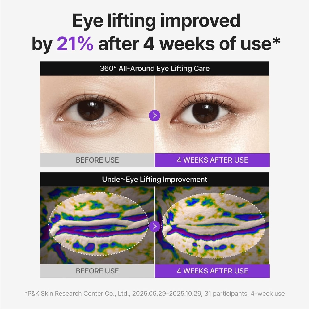 Centellian 24+ 360º Shot PDRN Lifting Eye Cream, 30ml. Подтягивающий и укрепляющий лифтинг-крем для век с PDRN и ретинолом Centellian 24+ 360º Shot PDRN Lifting Eye Cream, 30ml. Подтягивающий и укрепляющий лифтинг-крем для век с PDRN и ретинолом